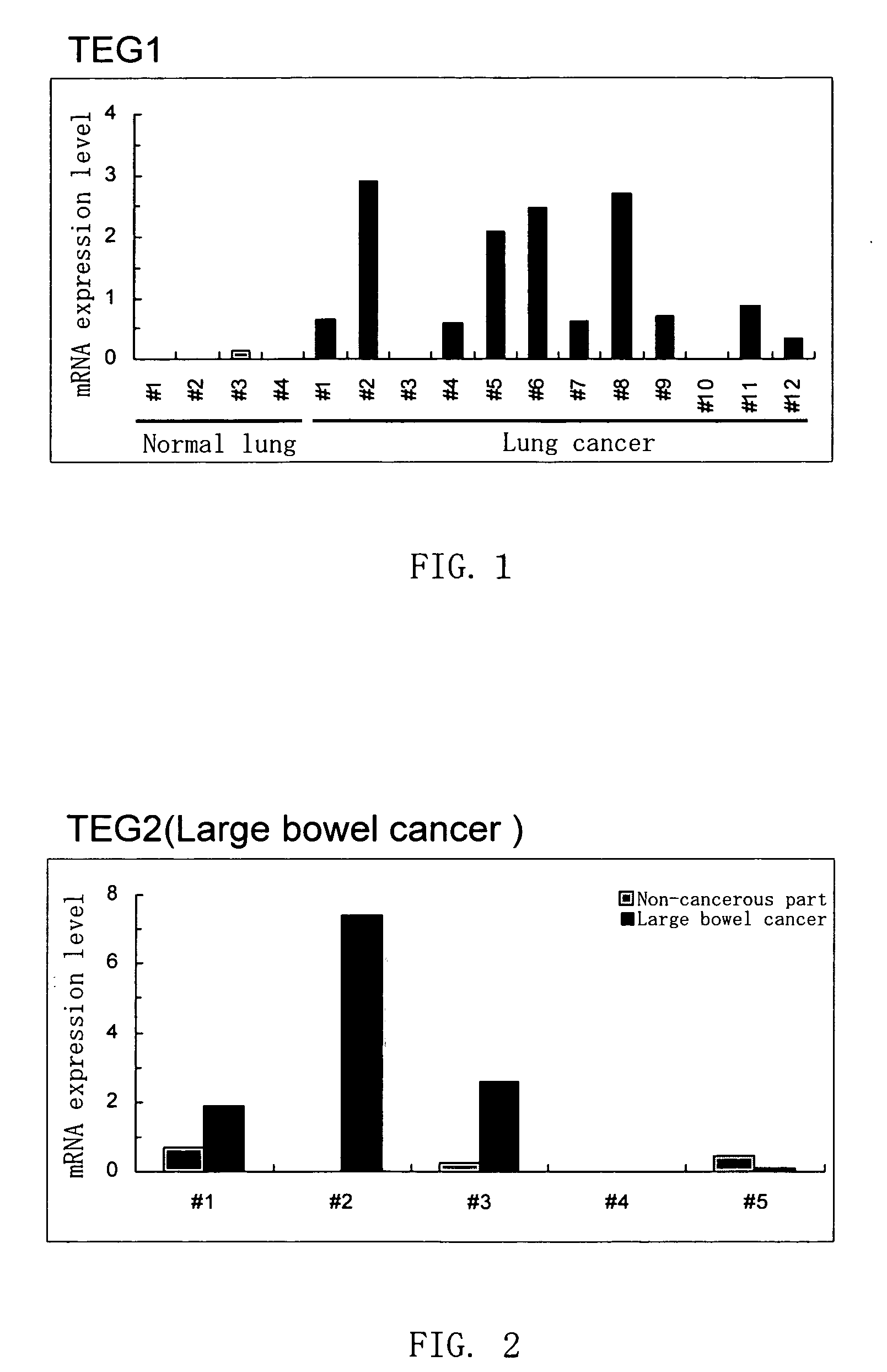 Gene overexpressed in cancer