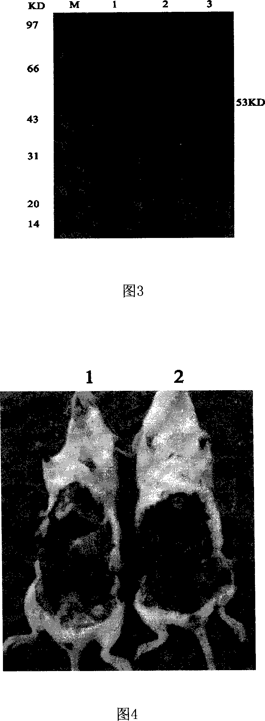 Micrococcus pyogenes alpha-hemolysin and coded sequence thereof