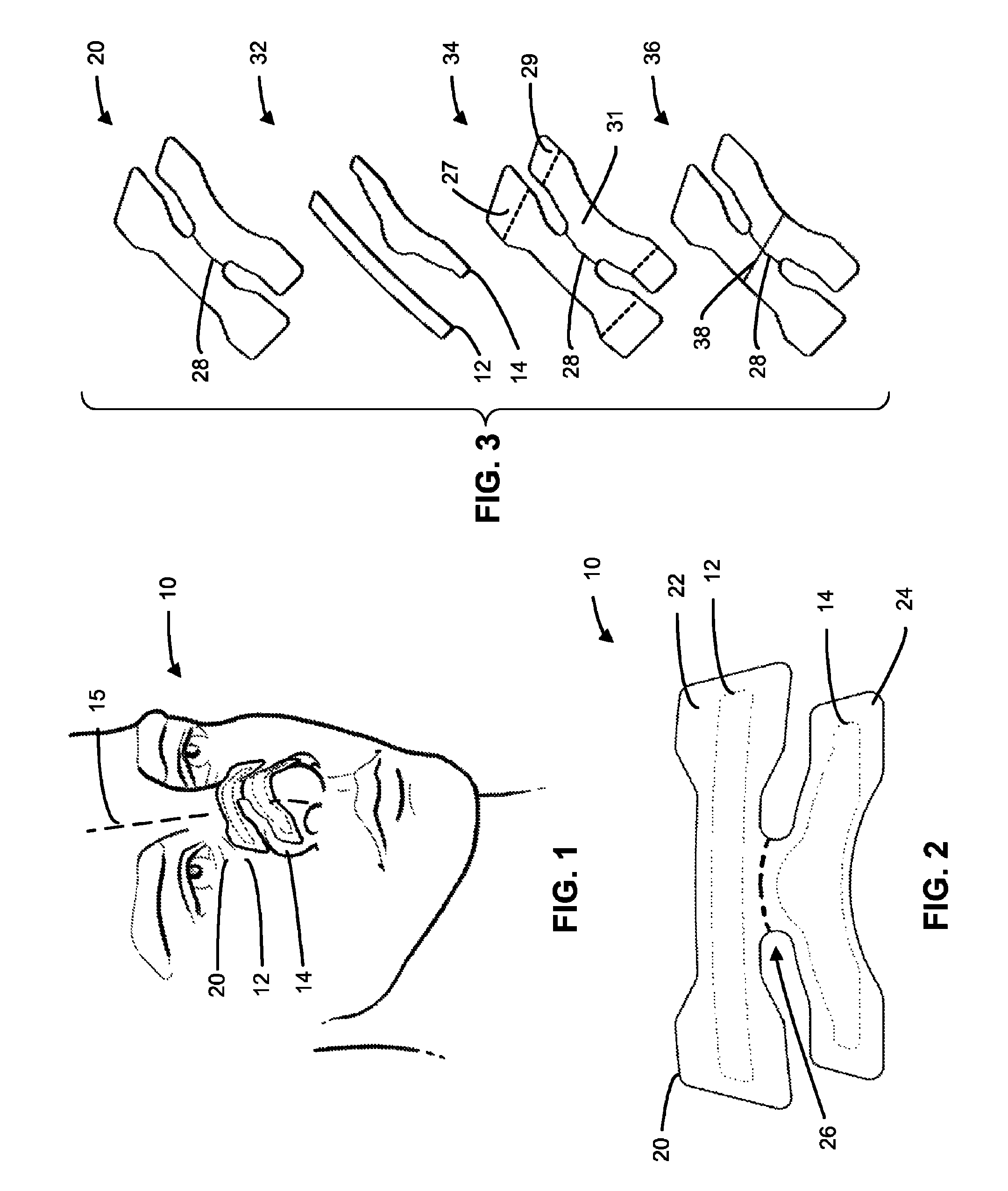 Nasal dilator