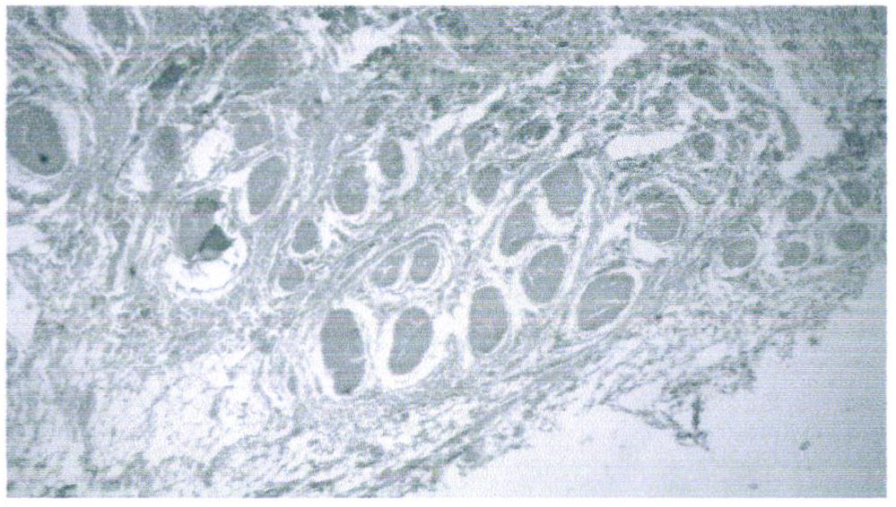 Application of a root extract of Artemisia syringae in preparation of medicine for treating allergic rhinitis