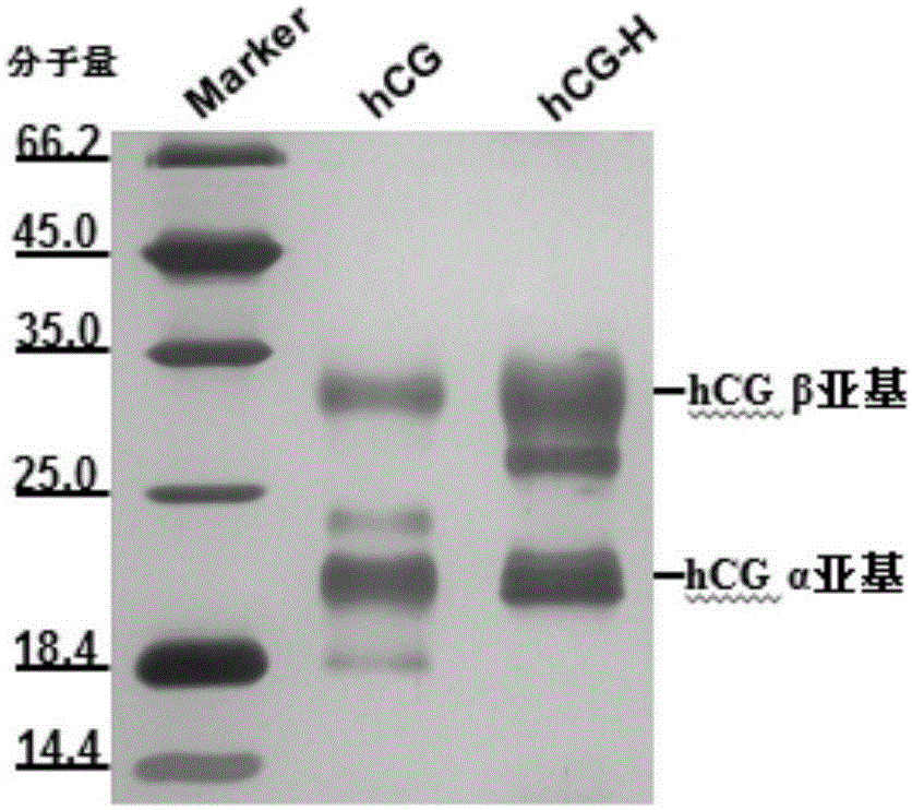 Detection kit for hyperglycosylated modification of hCG (human chorionic gonadotropin) tumor marker