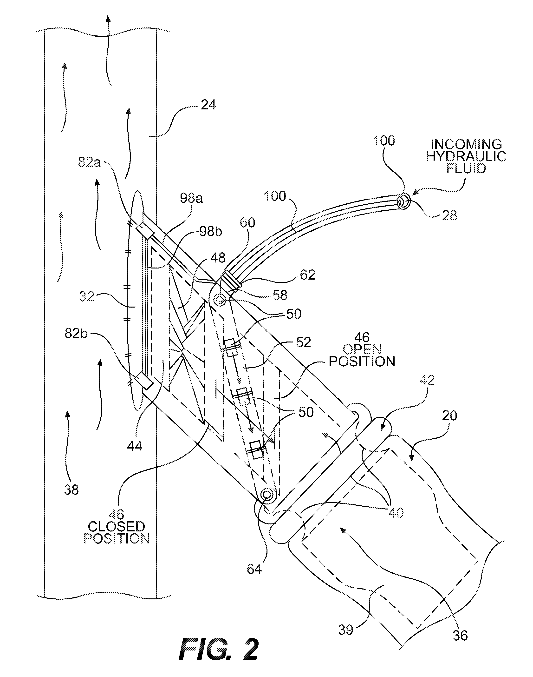 Arteriovenous shunt with integrated surveillance system