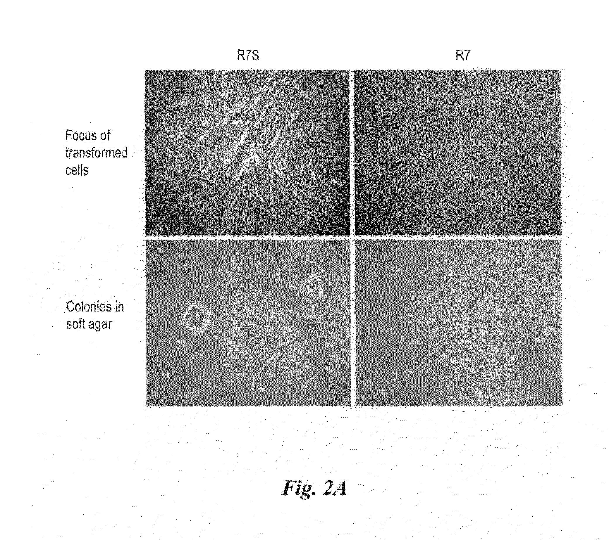 Method for preparing human neoplastically transformed cells