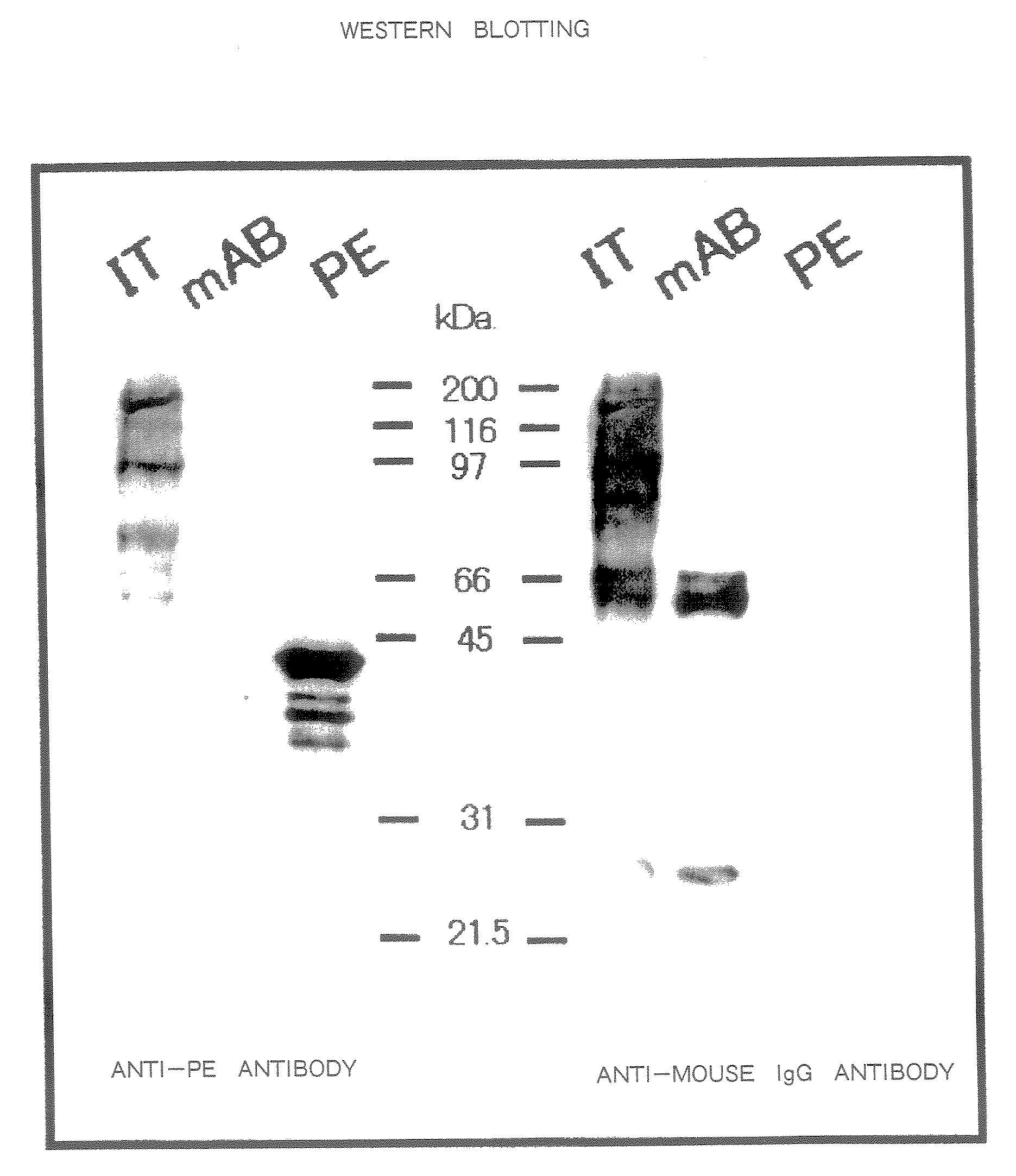 Therapeutic Medicine Containing Monoclonal Antibody Against Folate Receptor Beta (Fr-Beta)