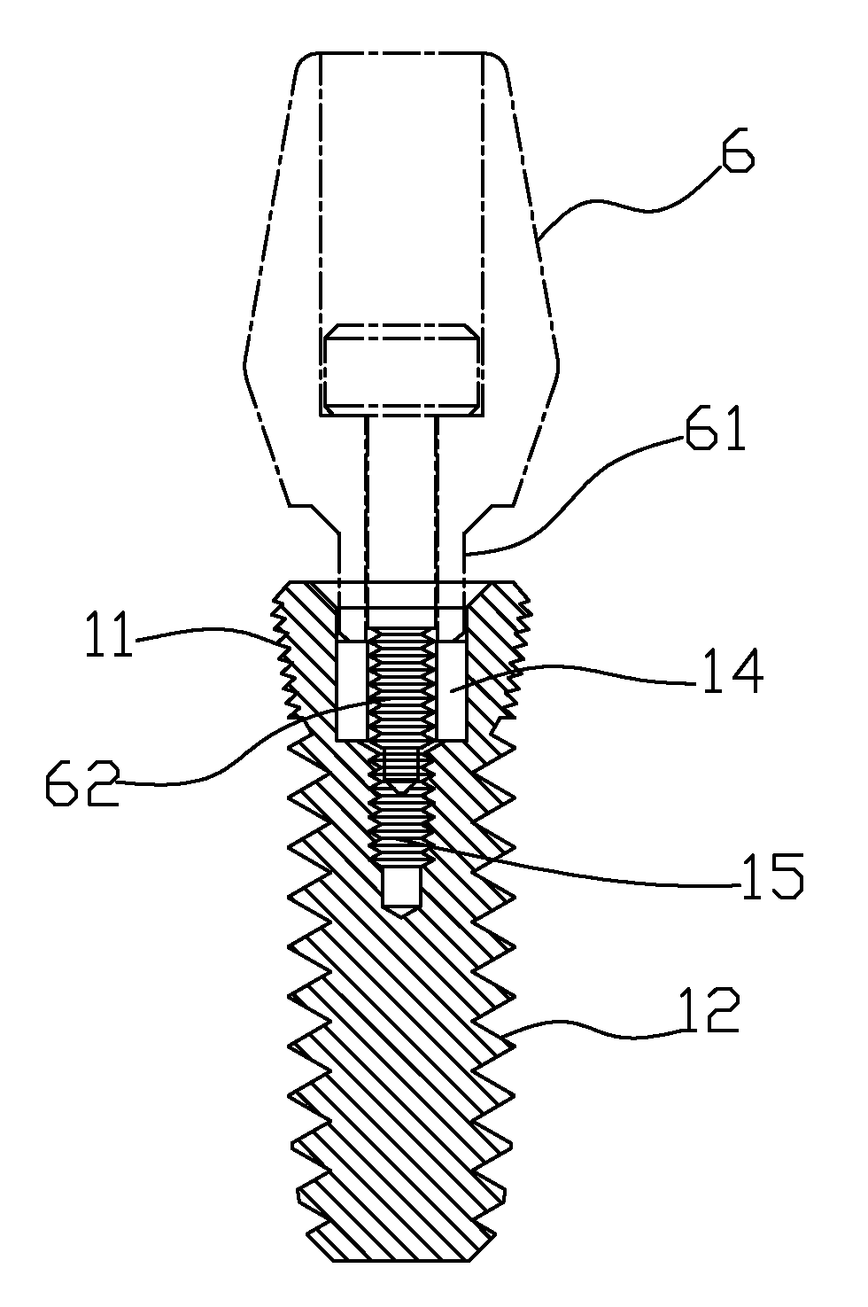 Implant root for tooth implanting