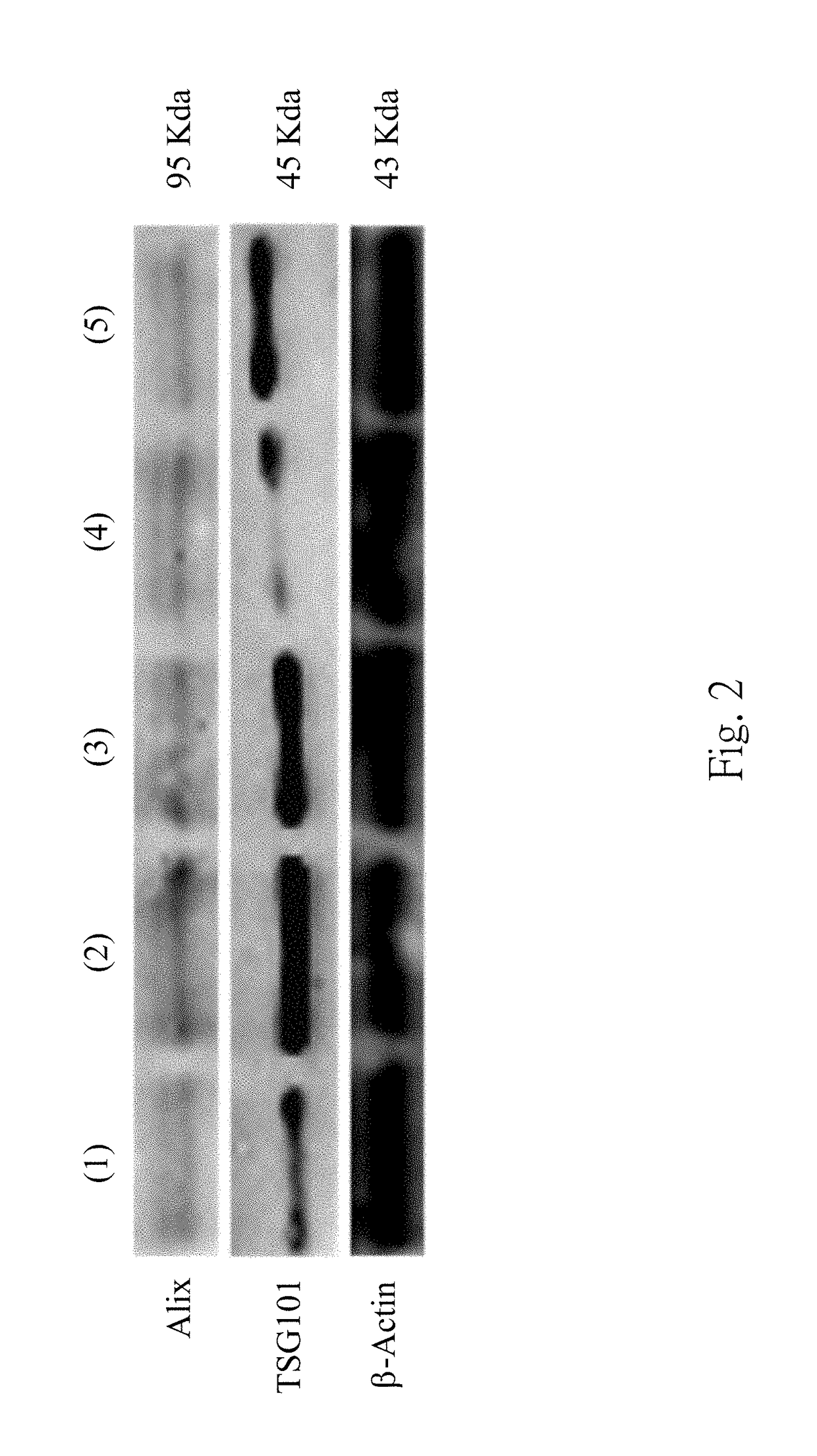 Method For Predicting Recurrence And Progression Of Urothelial Cancer Patient After Treatment