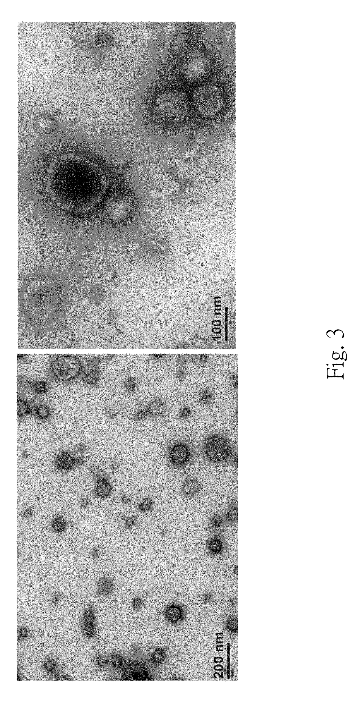 Method For Predicting Recurrence And Progression Of Urothelial Cancer Patient After Treatment