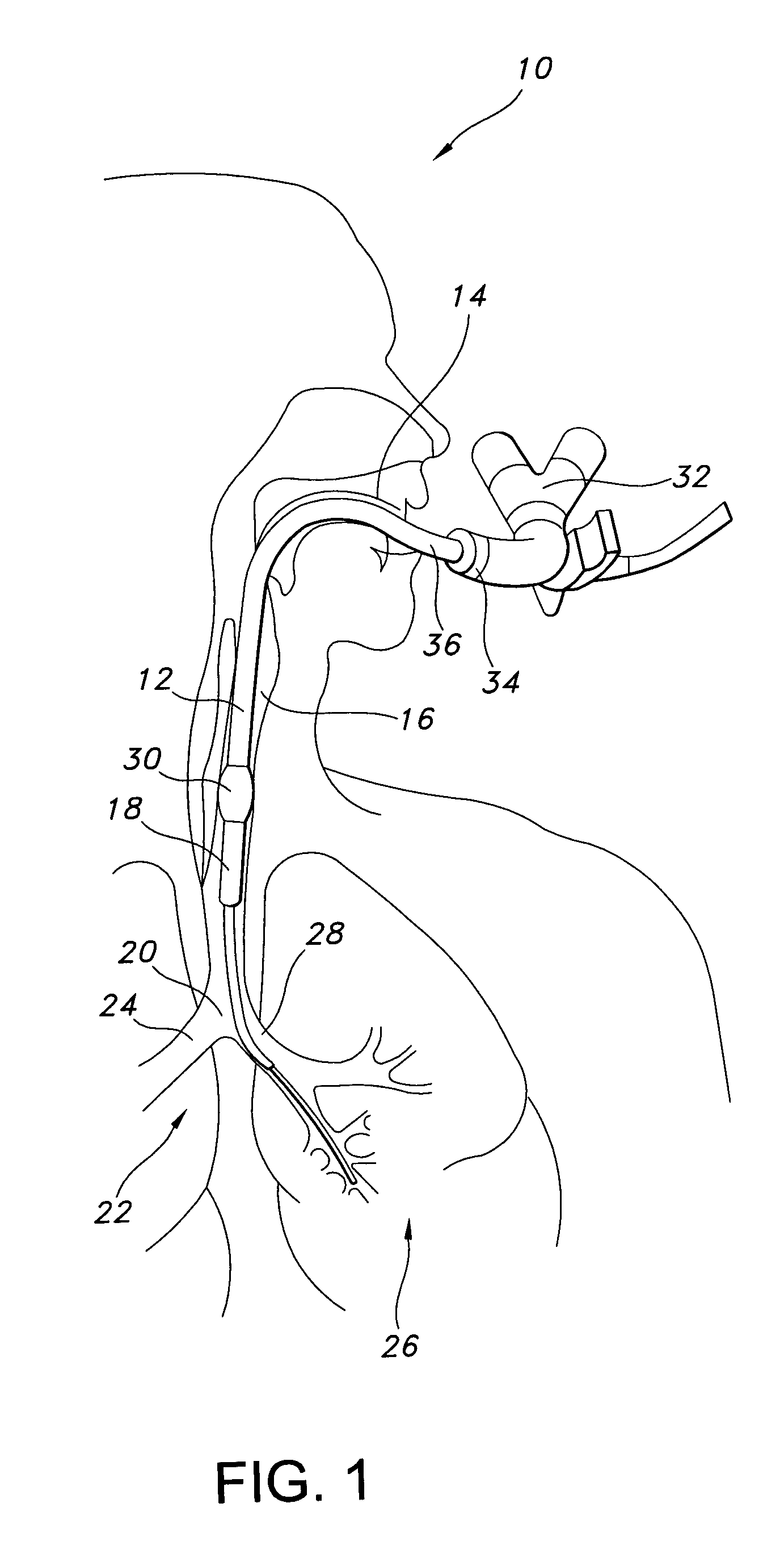 Multilumen tracheal catheter to prevent cross contamination