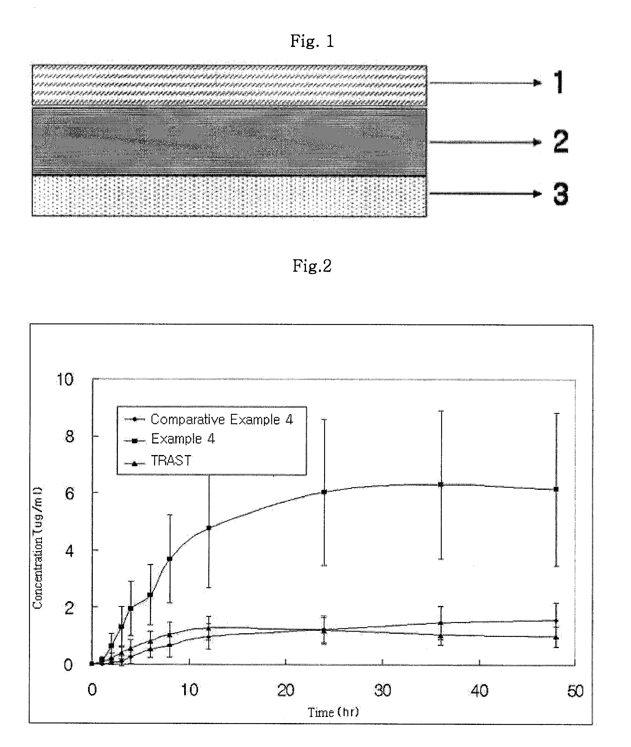 Preparation and composition of meloxicam transdermal drug delivery system