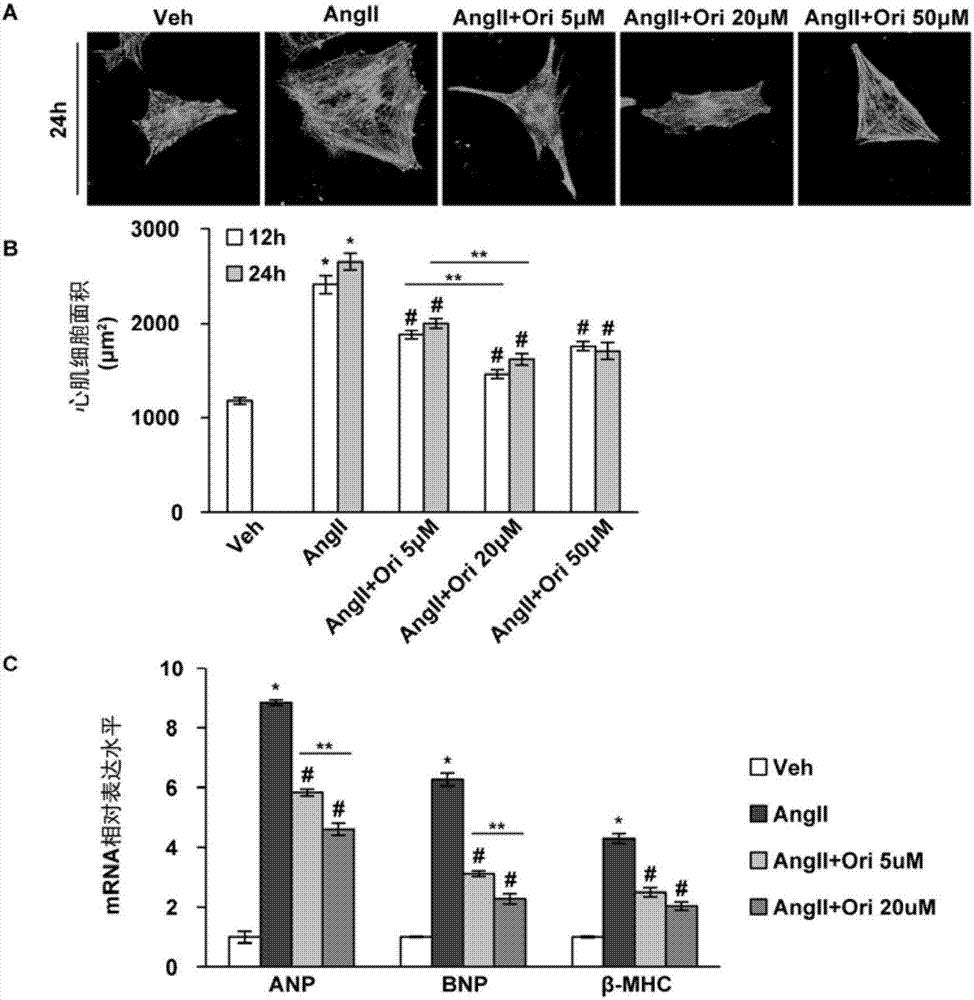 Application of oridonin in preparation of cardiac remodeling resistant medicines