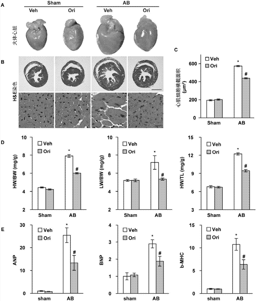 Application of oridonin in preparation of cardiac remodeling resistant medicines