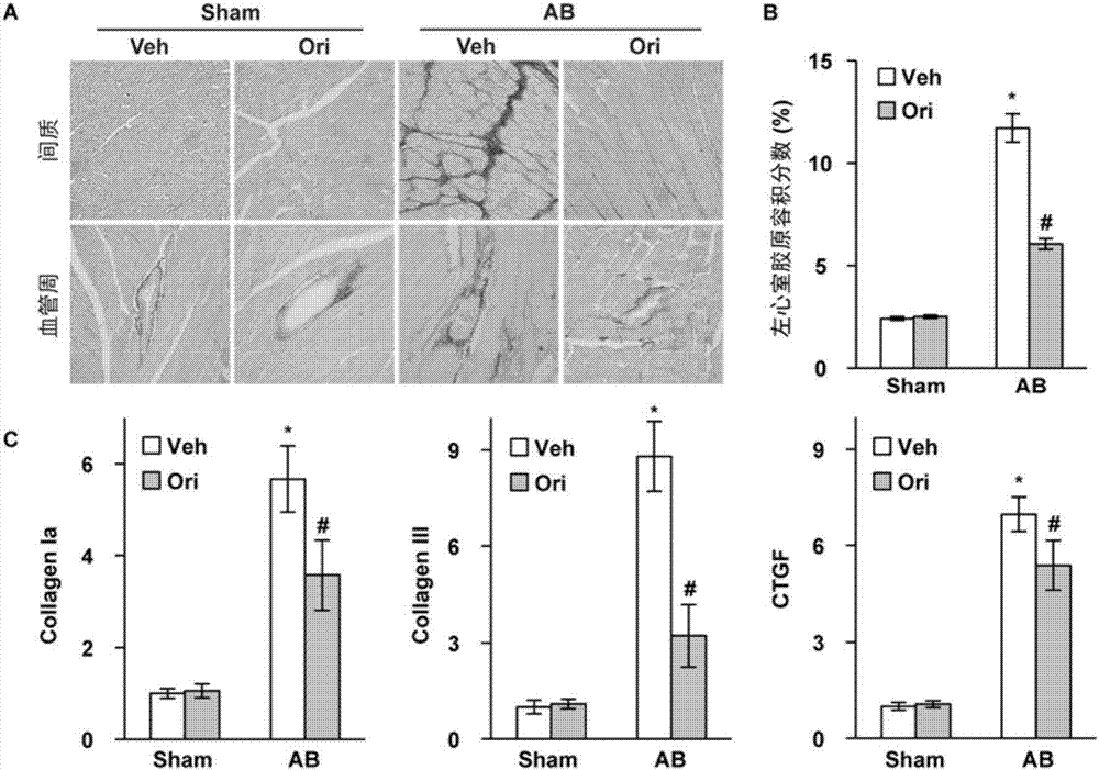 Application of oridonin in preparation of cardiac remodeling resistant medicines