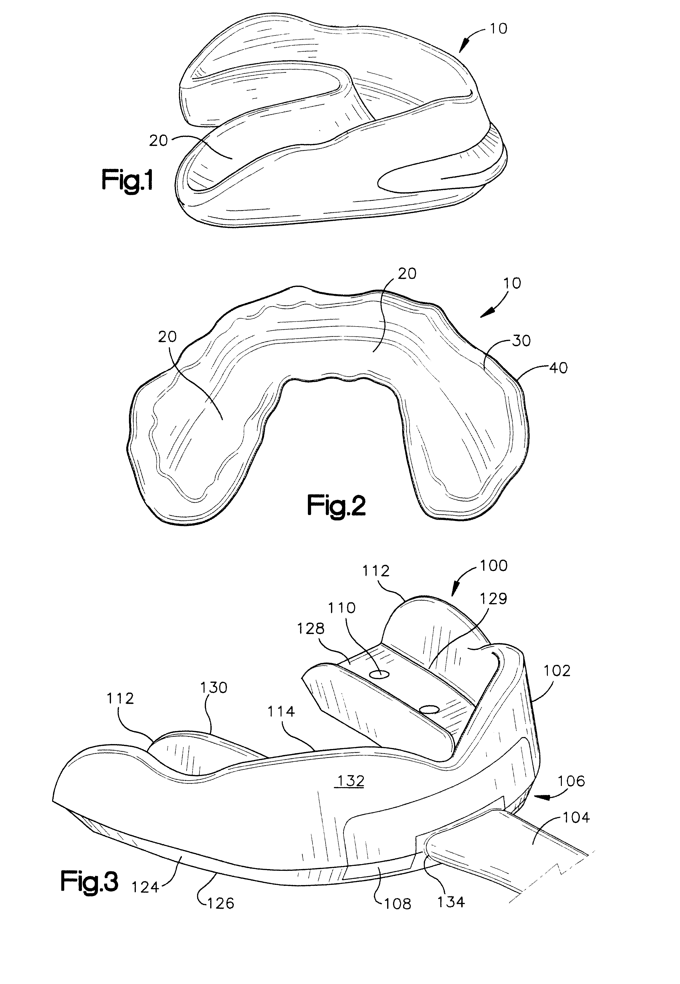 Mouthguard and method of making