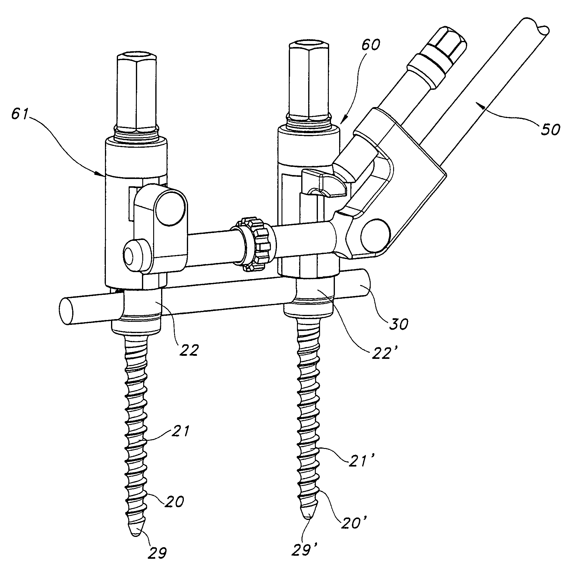 Bone repair device and method