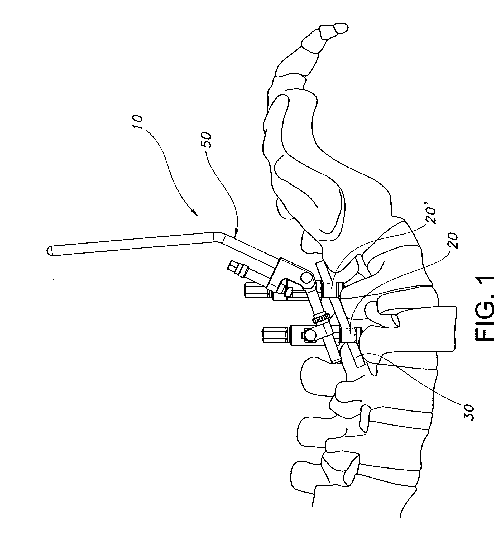 Bone repair device and method