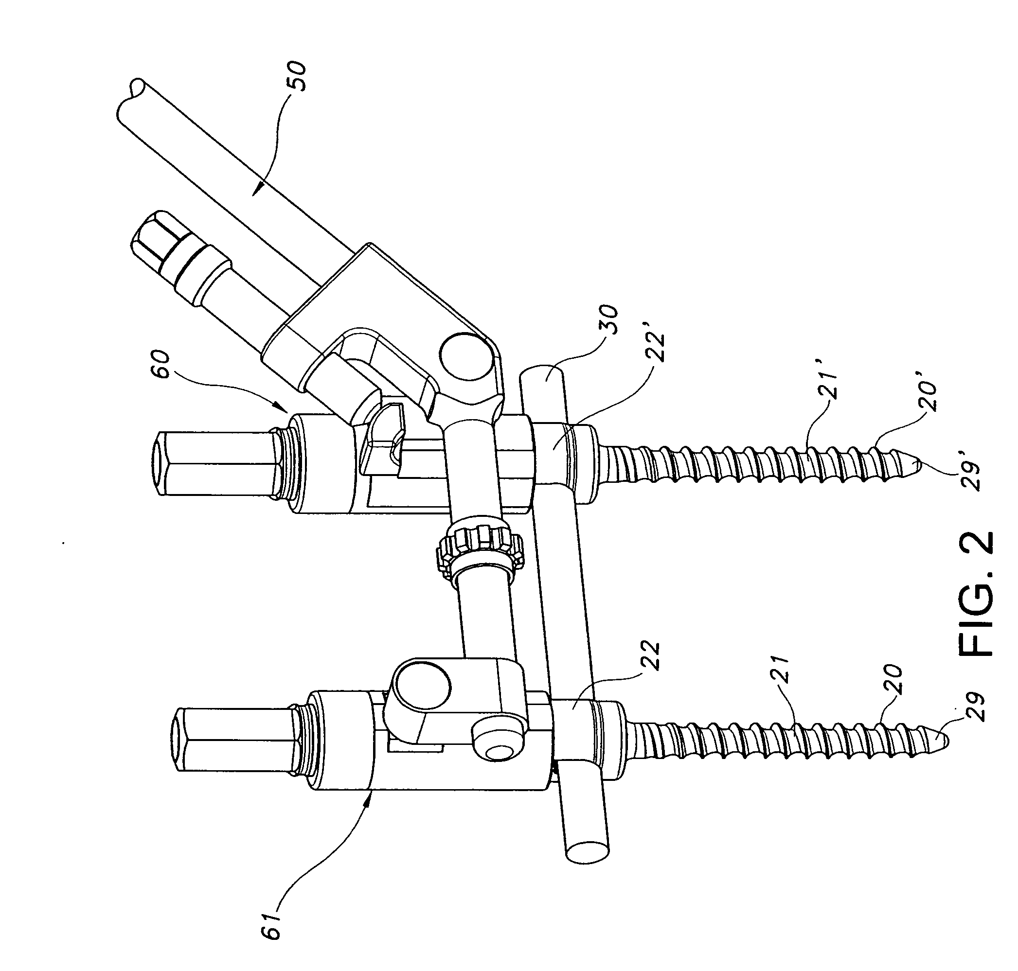 Bone repair device and method