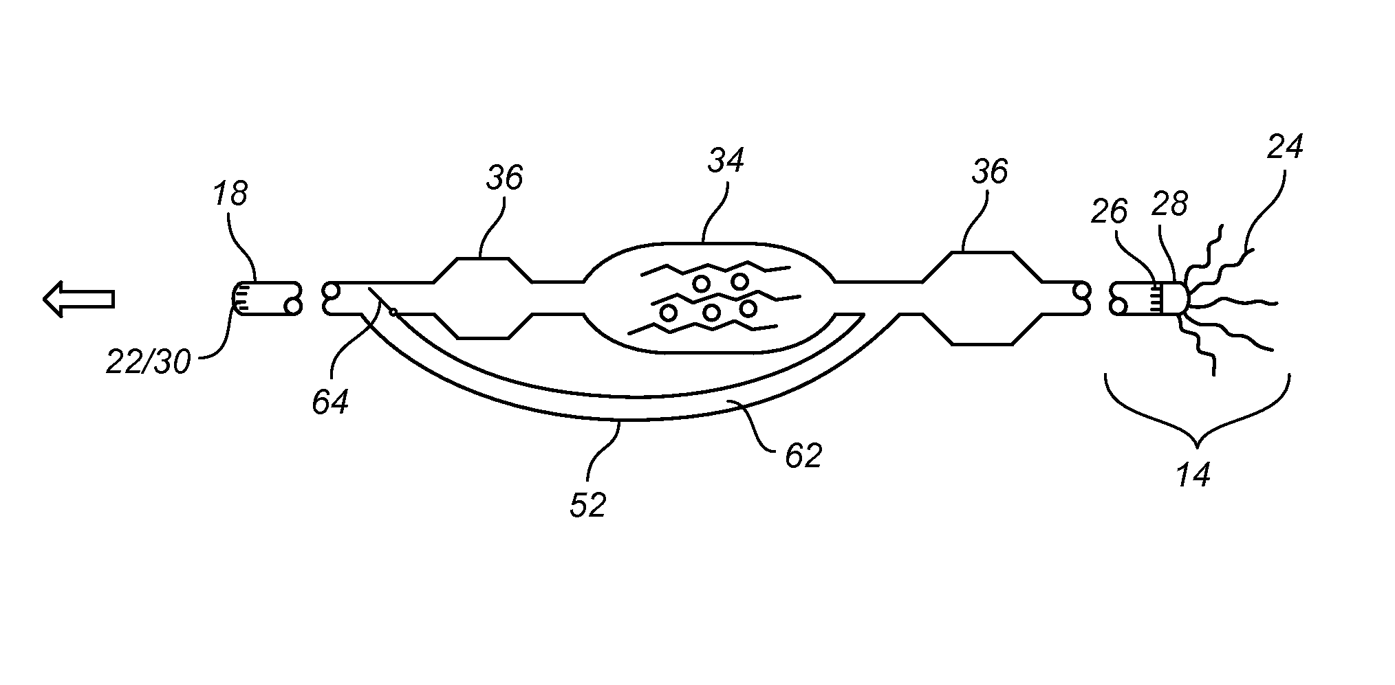 Implantable bioartificial perfusion system