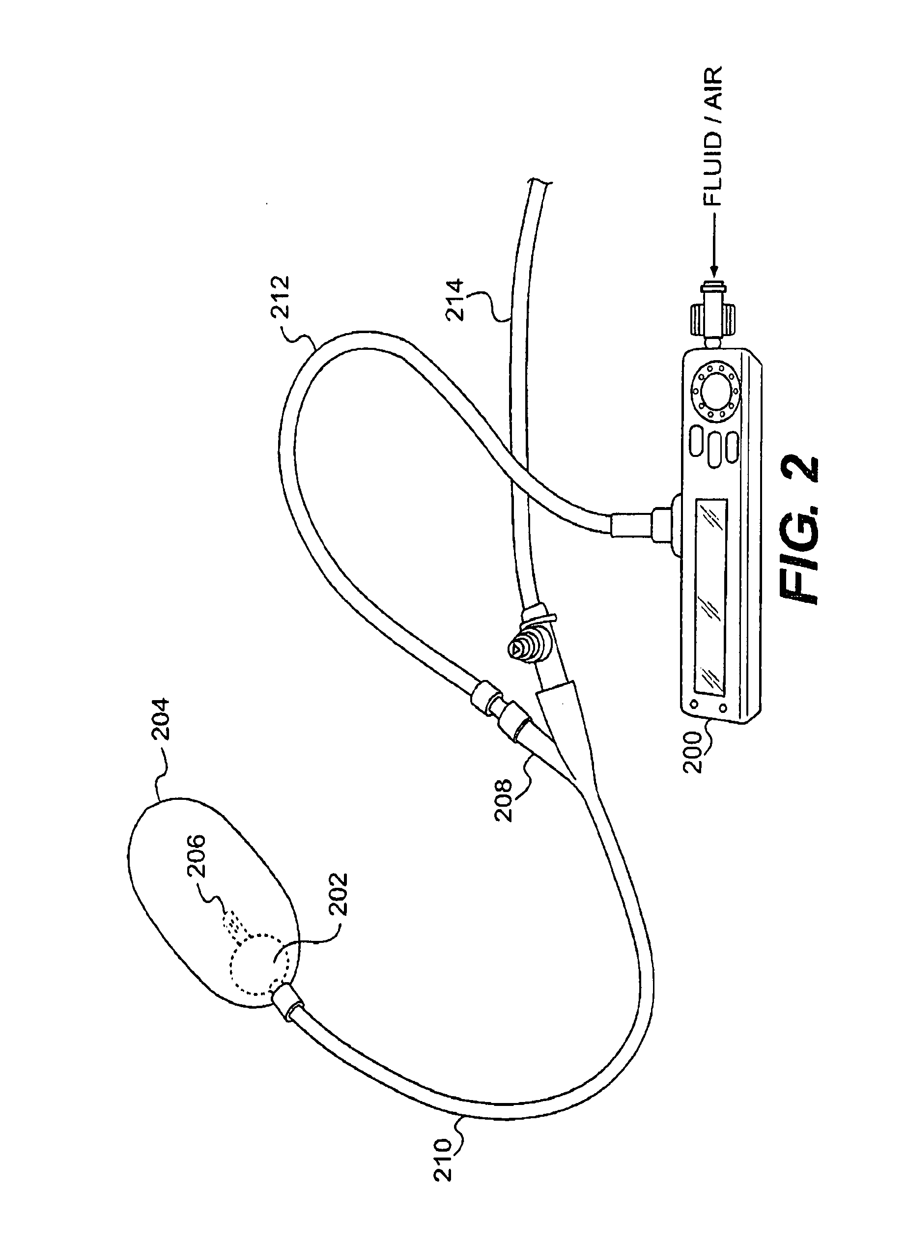 Acs therapy system