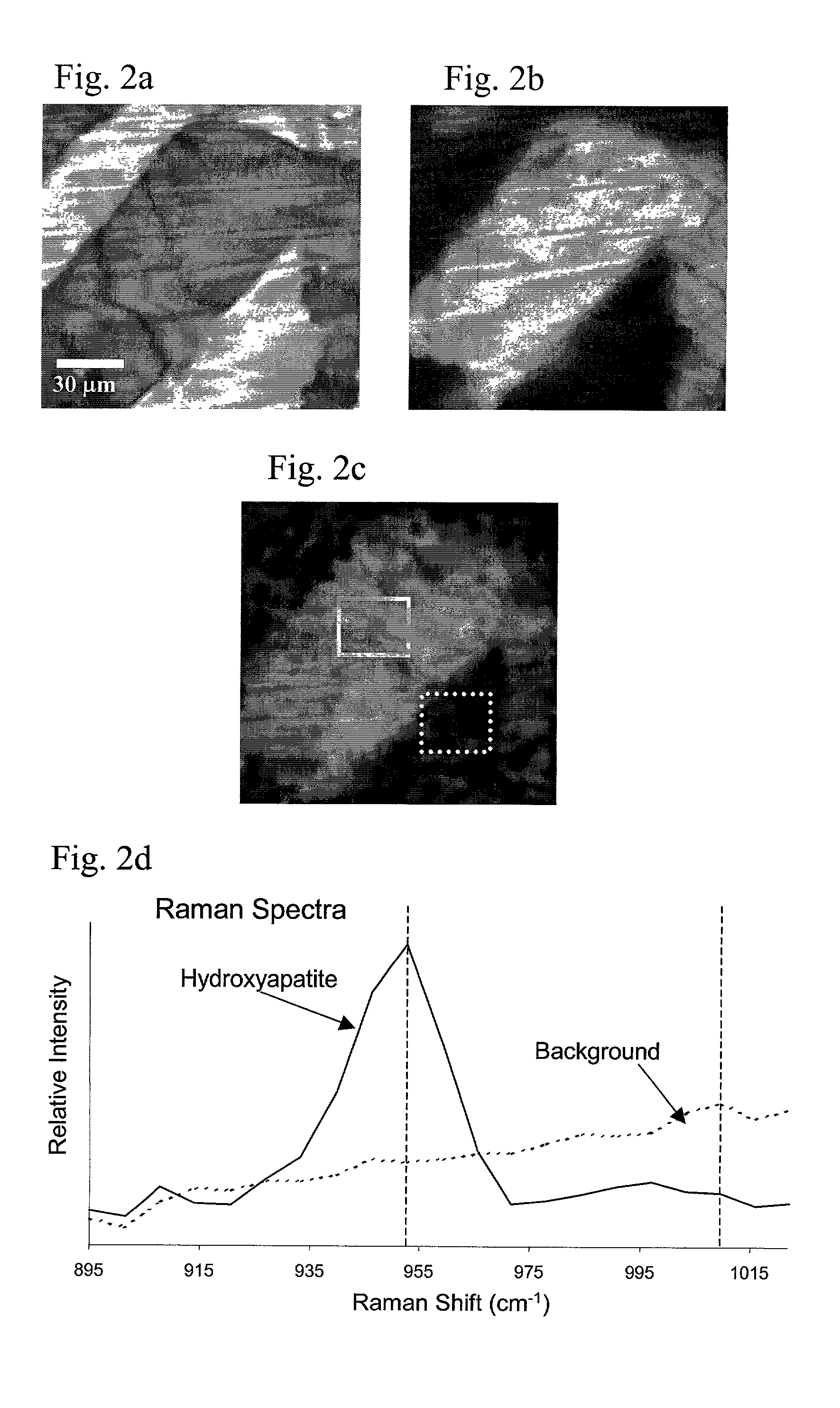 Method for Raman chemical imaging of endogenous chemicals to reveal tissue lesion boundaries in tissue