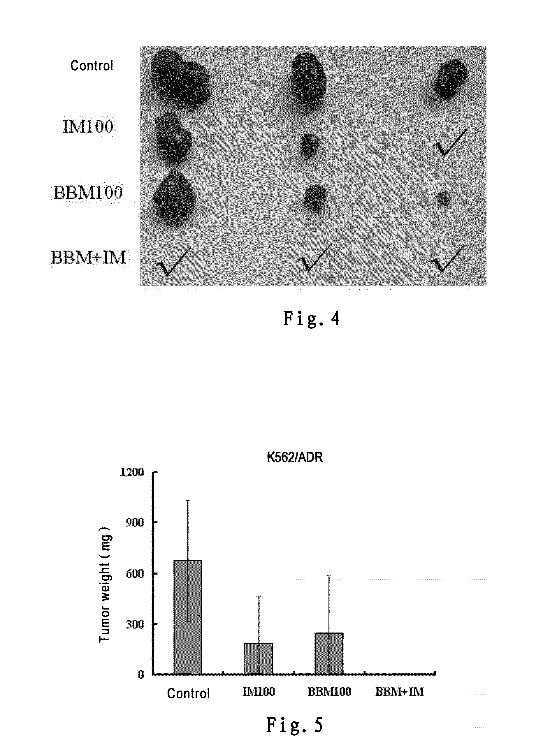 Drug composition for treating tumors and application thereof