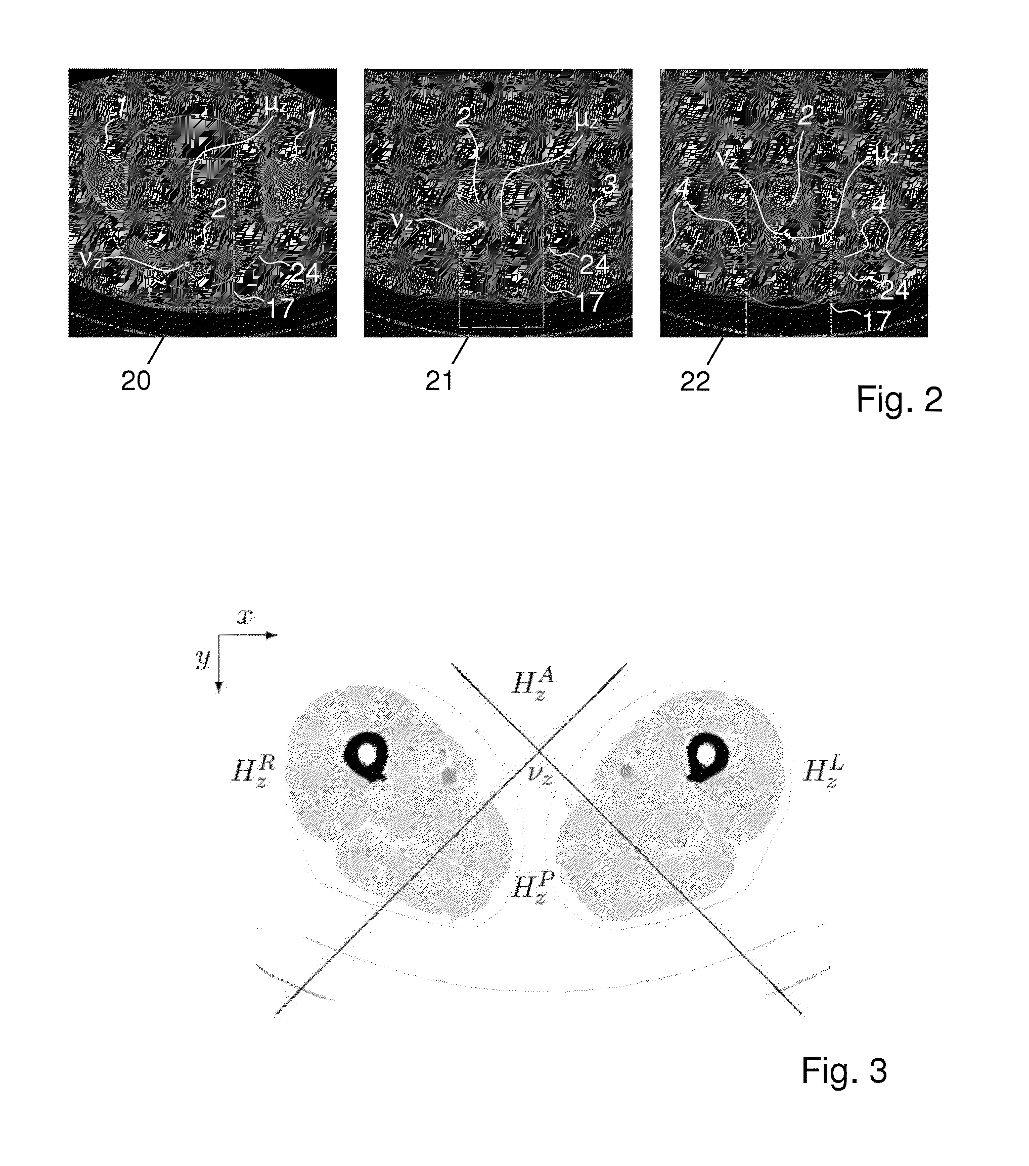 Method, apparatus and system for localizing a spine