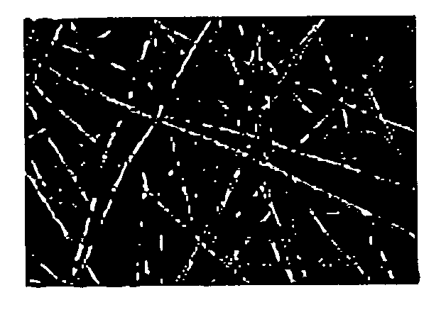 Aligned scaffolding system for skeletal muscle regeneration