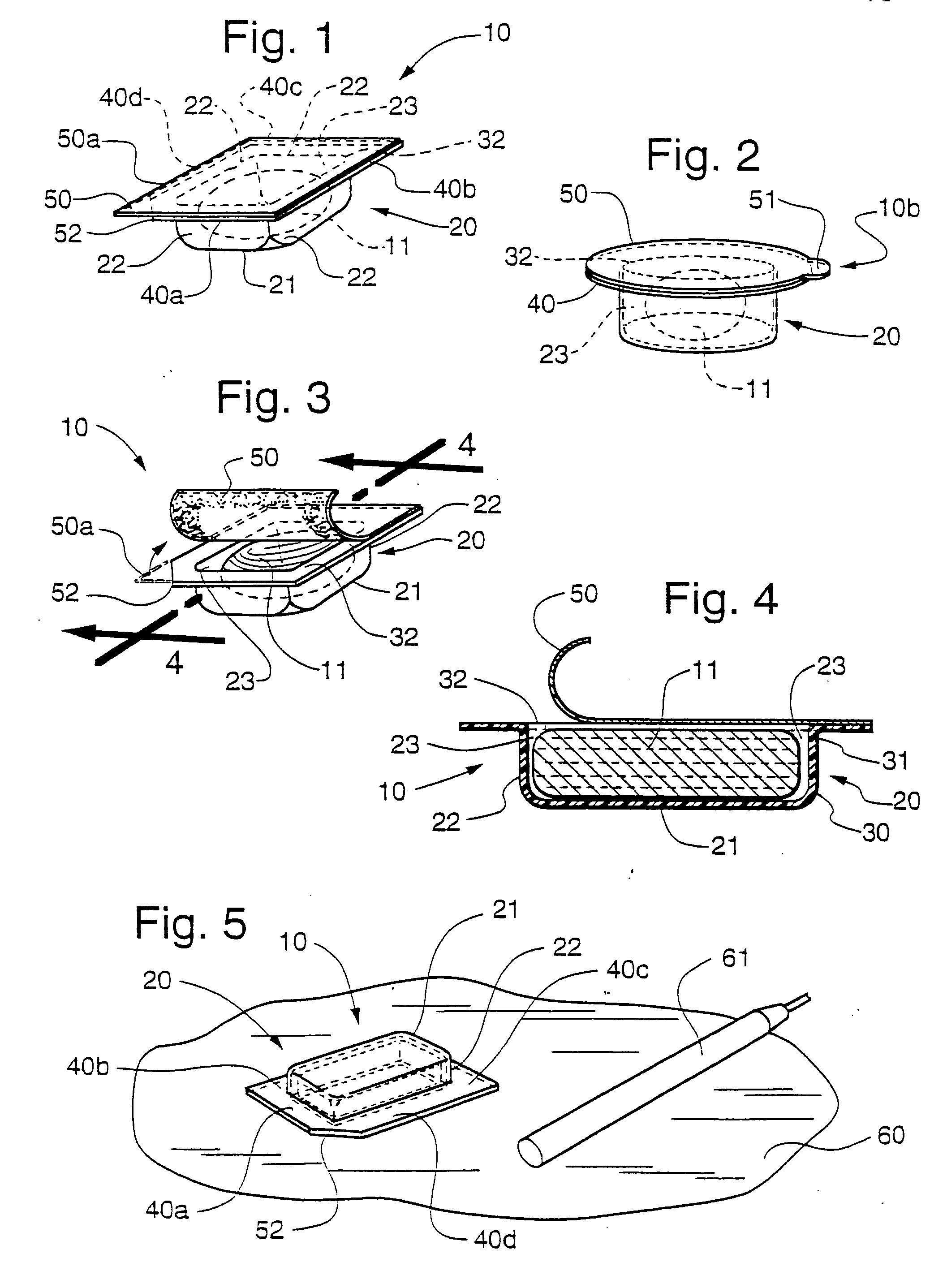 Dental composite restorative material and method of restoring a tooth