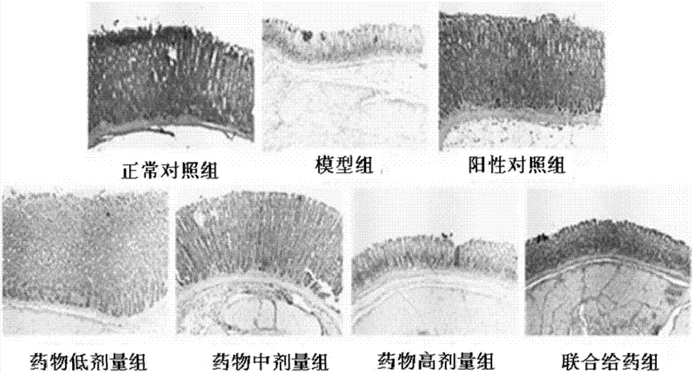 Application of pharmaceutical composition in preparation of Chinese herba preparation for treating functional dyspepsia