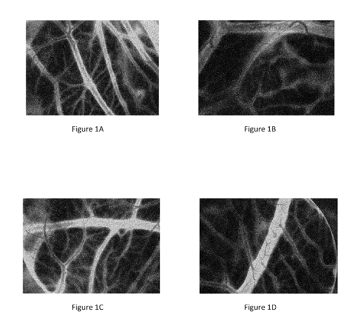 Specific oligopeptides as Anti-angiogenic drugs