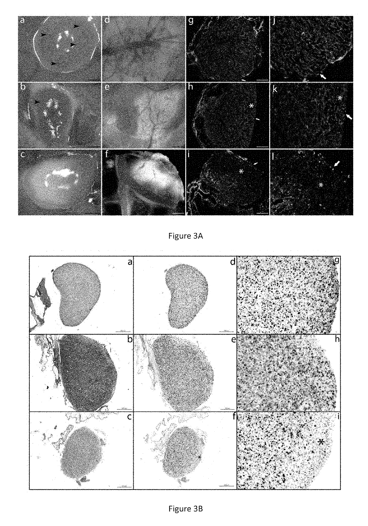 Specific oligopeptides as Anti-angiogenic drugs