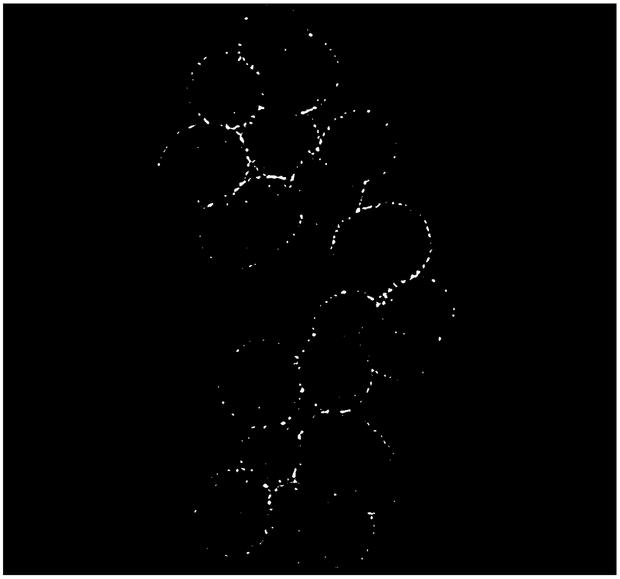 Black phosphorus quantum dot/platinum hybrid mesoporous silica nanoparticles and preparation method and application thereof