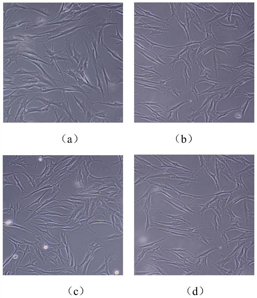 Human fibroblast serum-free medium and preparation method and method for obtaining human fibroblast serum-free conditioned medium