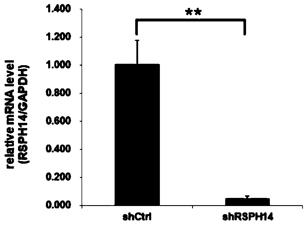 Application of RSPH14 gene, application of RSPH14 inhibitor, nucleic acid molecule, construct and composition