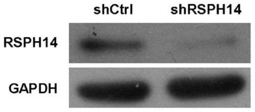 Application of RSPH14 gene, application of RSPH14 inhibitor, nucleic acid molecule, construct and composition