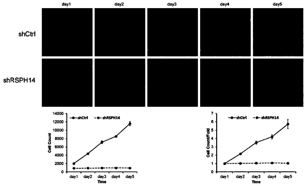 Application of RSPH14 gene, application of RSPH14 inhibitor, nucleic acid molecule, construct and composition