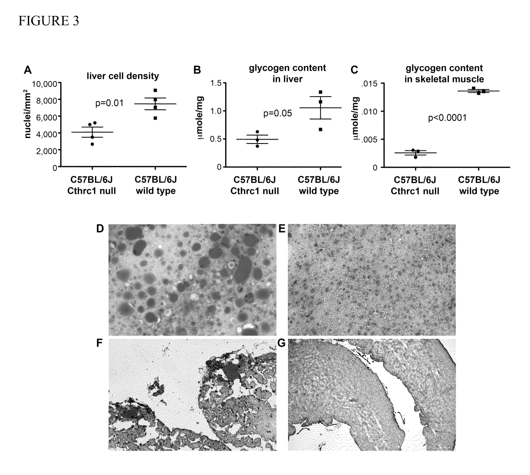 Methods for treating metabolic syndrome with Cthrc1 polypeptide