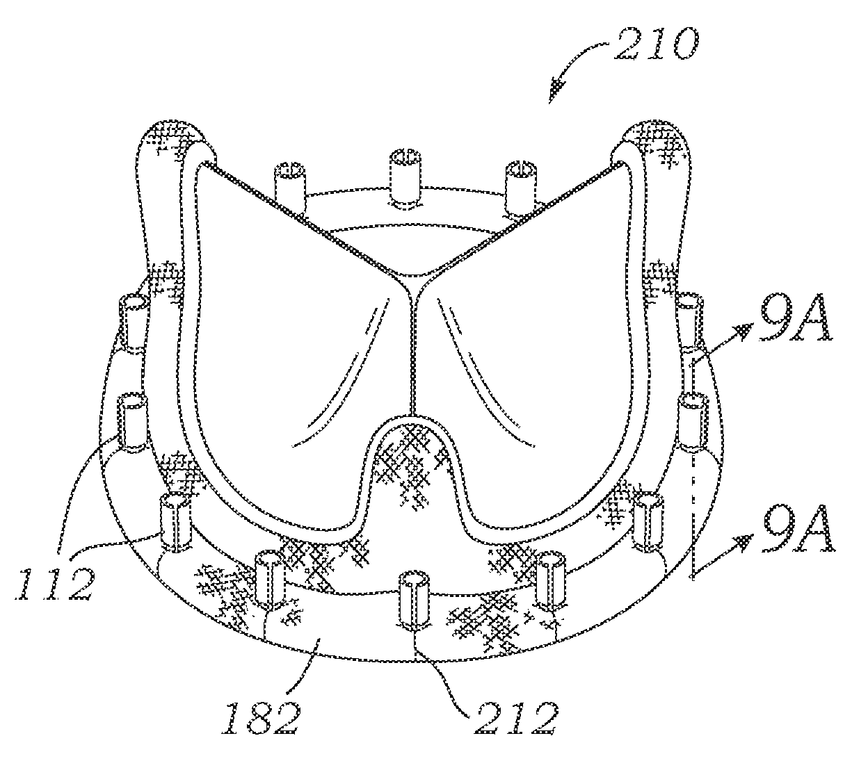 Cardiac implant with integrated suture fasteners