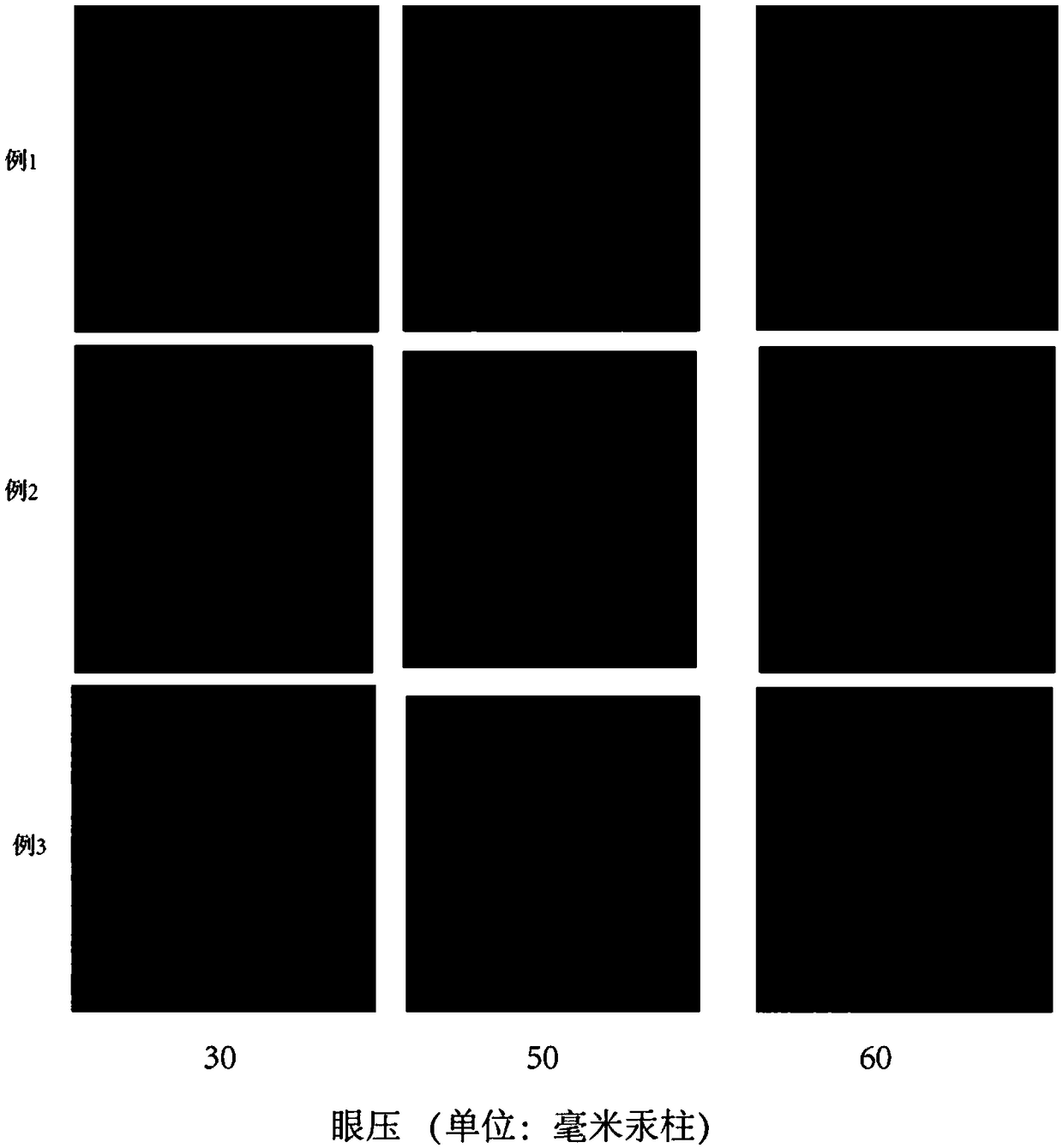 Method for detecting whether retina is damaged or not