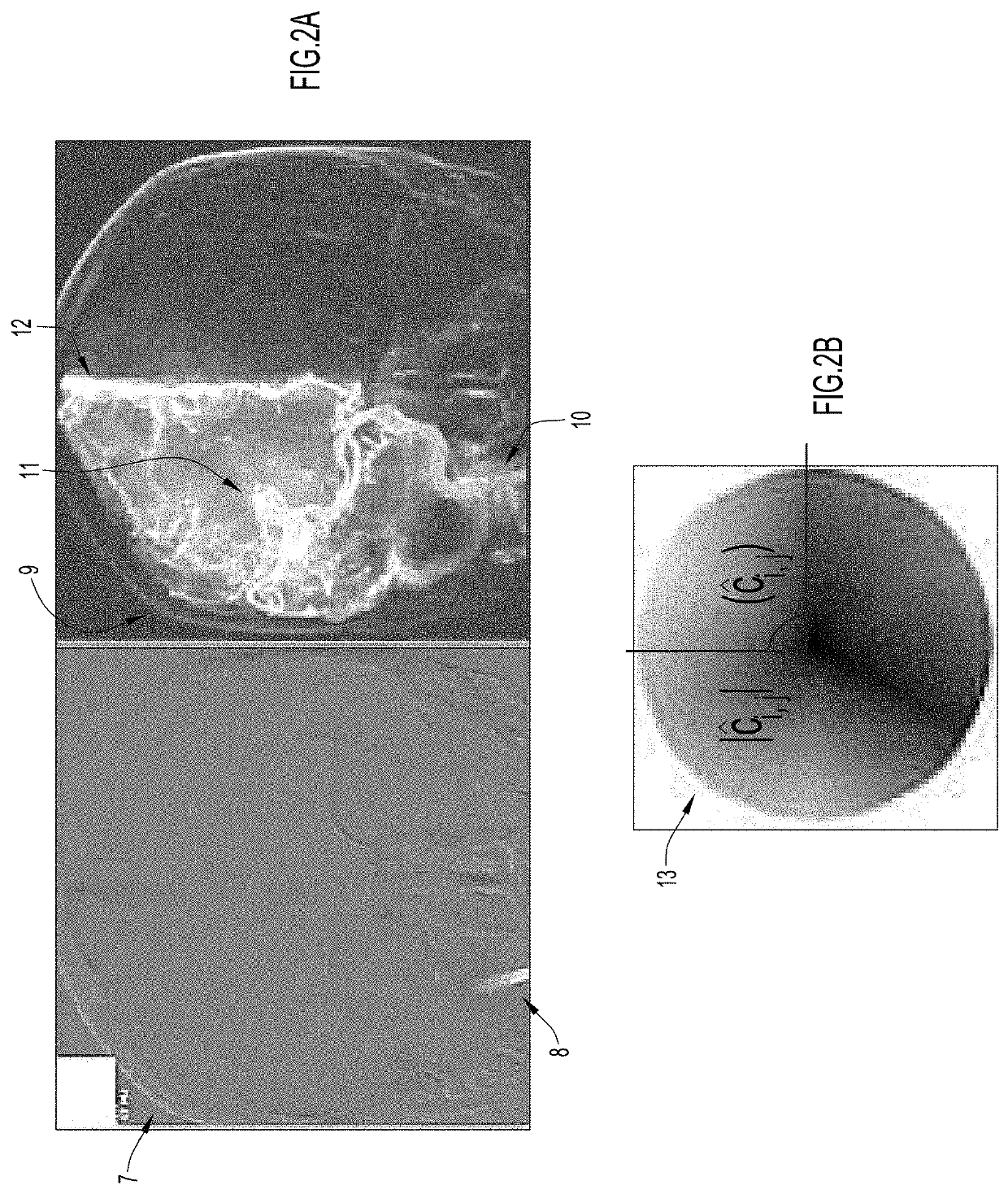 Methods for angiography