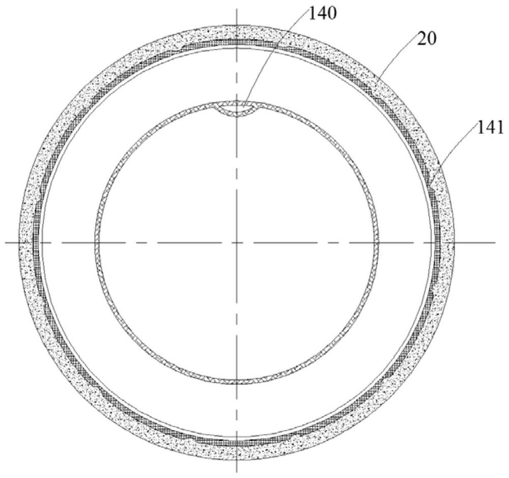 Intelligent protection device for intestinal tract after intestinal surgery