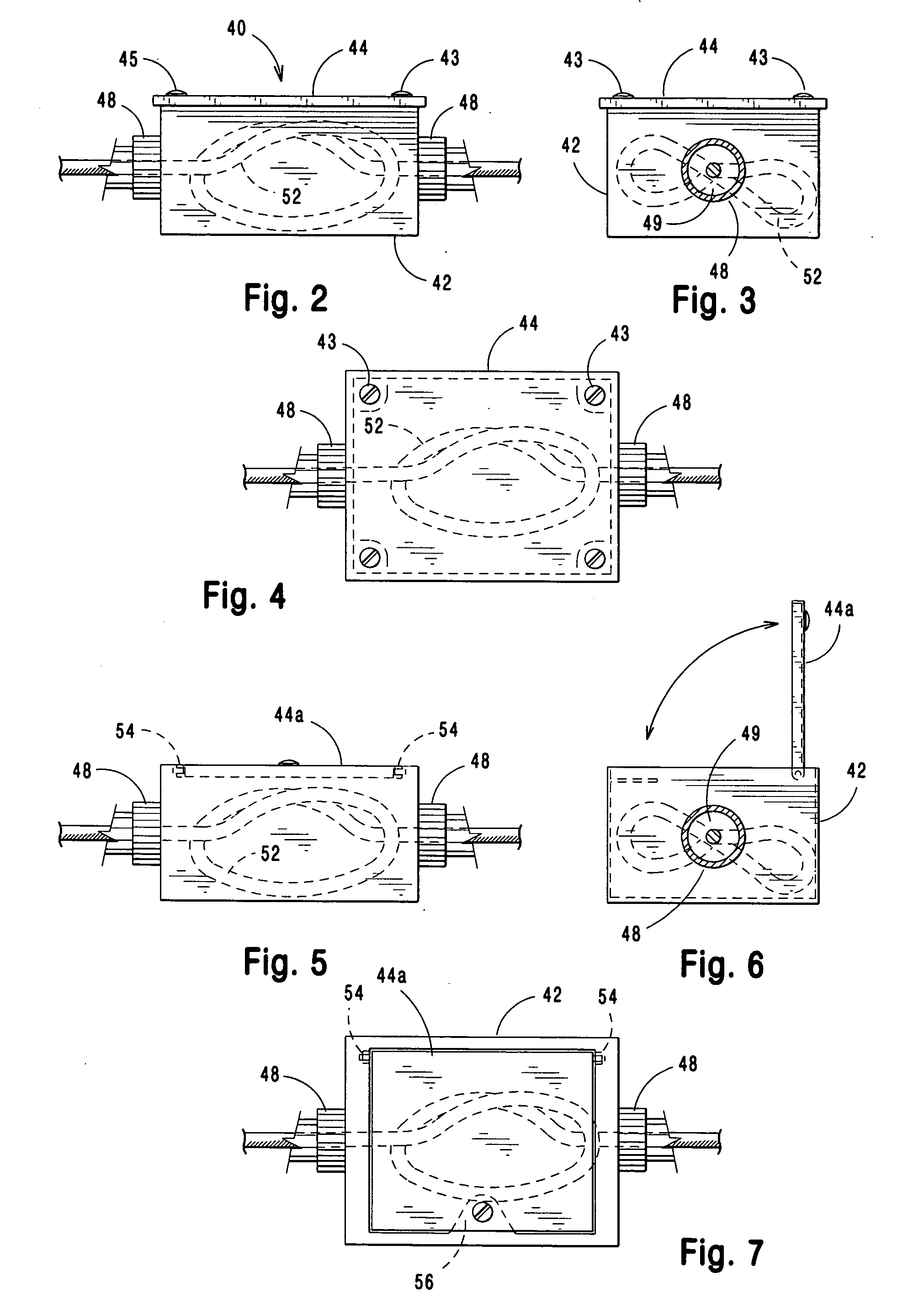 Slack cable arrangement for underground electric service conduit connected to service boxes on the sides of buildings