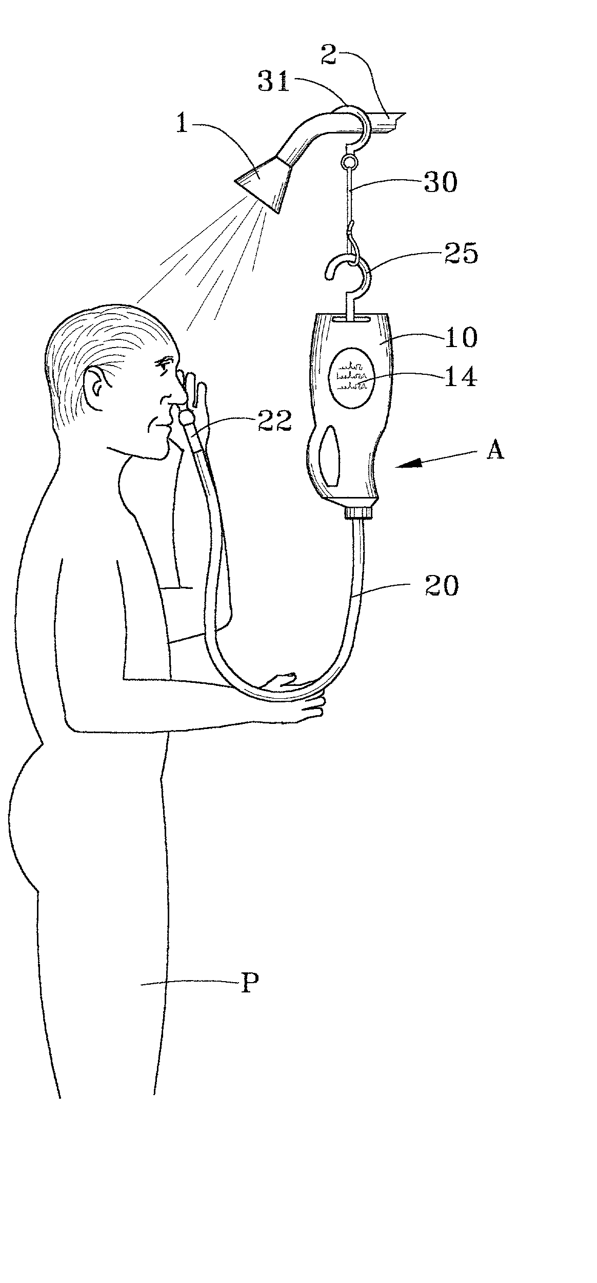 Sinus and nasal irrigating apparatus