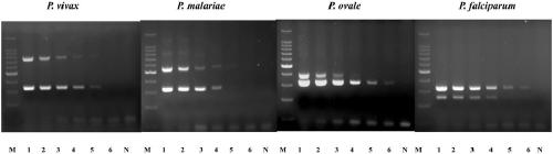 Chimeric primer multiplex PCR molecular detection kit and detection method for simultaneous detection of malaria species