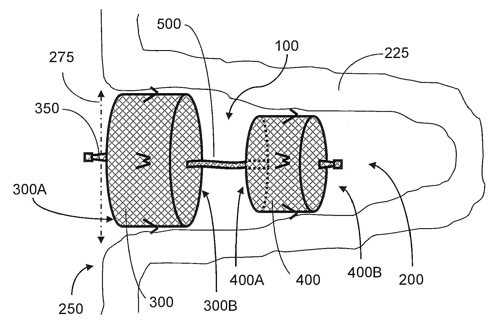 Occlusion device and associated deployment method