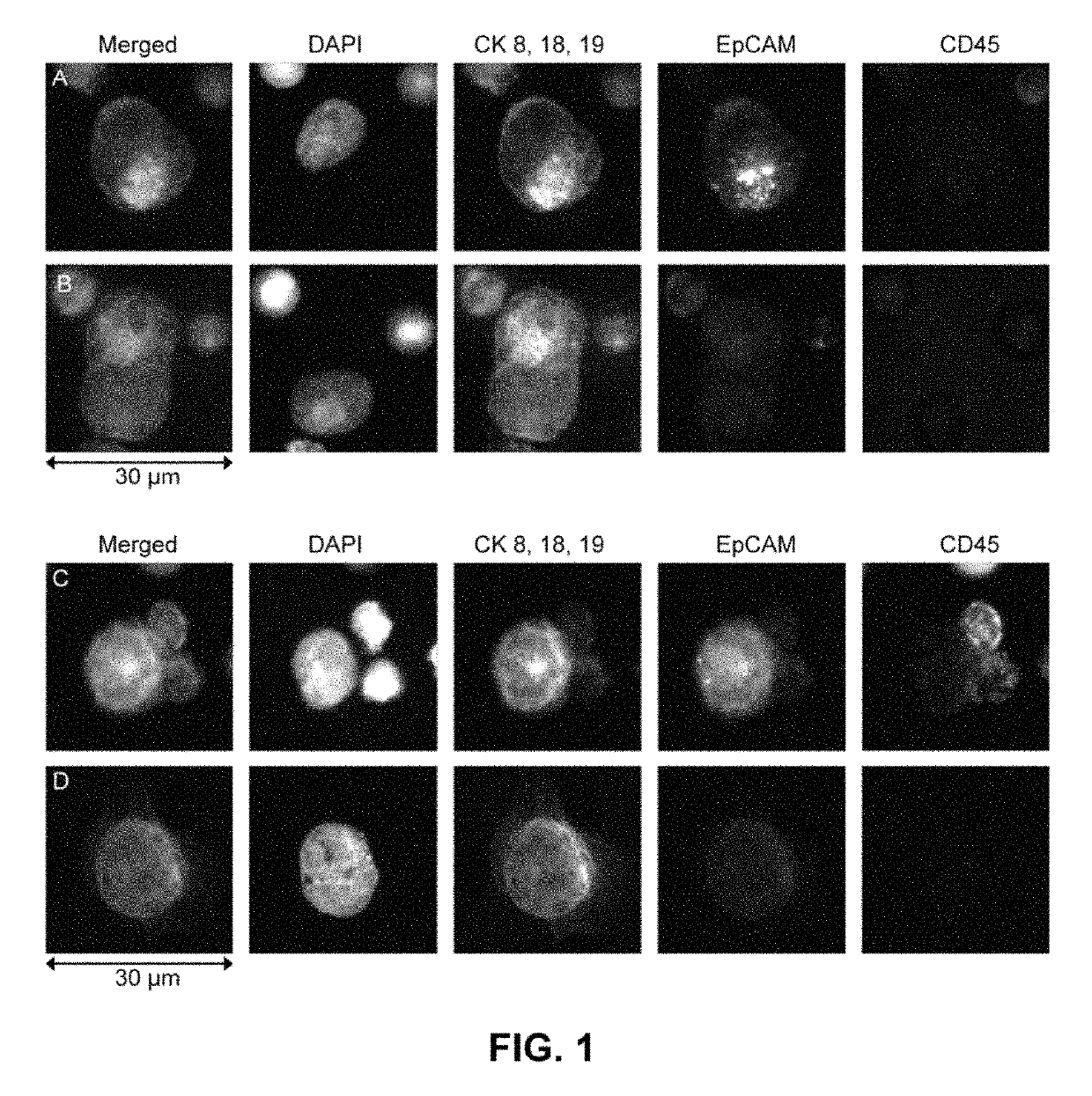 Capture, identification and use of a new biomarker of solid tumors in body fluids