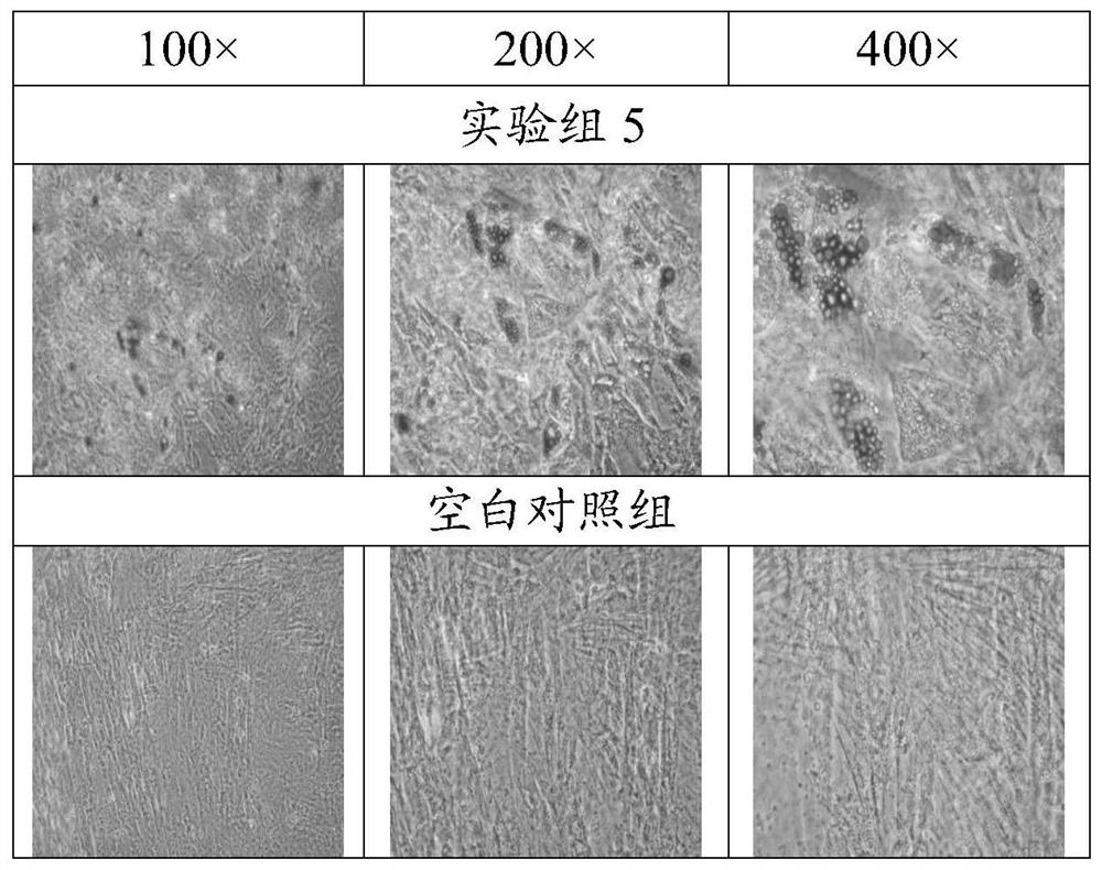 A culture medium and its application and method for inducing tendon stem cells to differentiate into fat cells