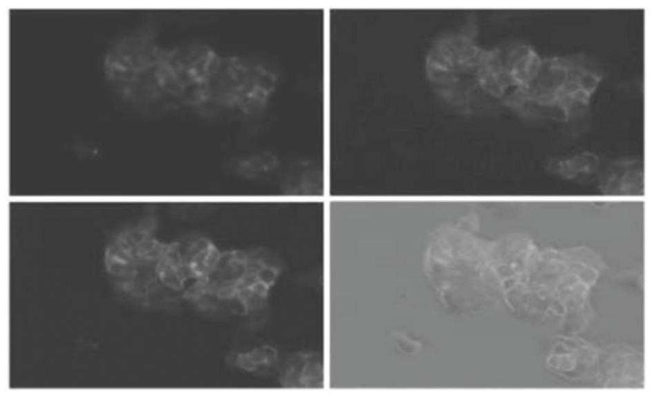 Genetically engineered cells sensitive to clostridial neurotoxins