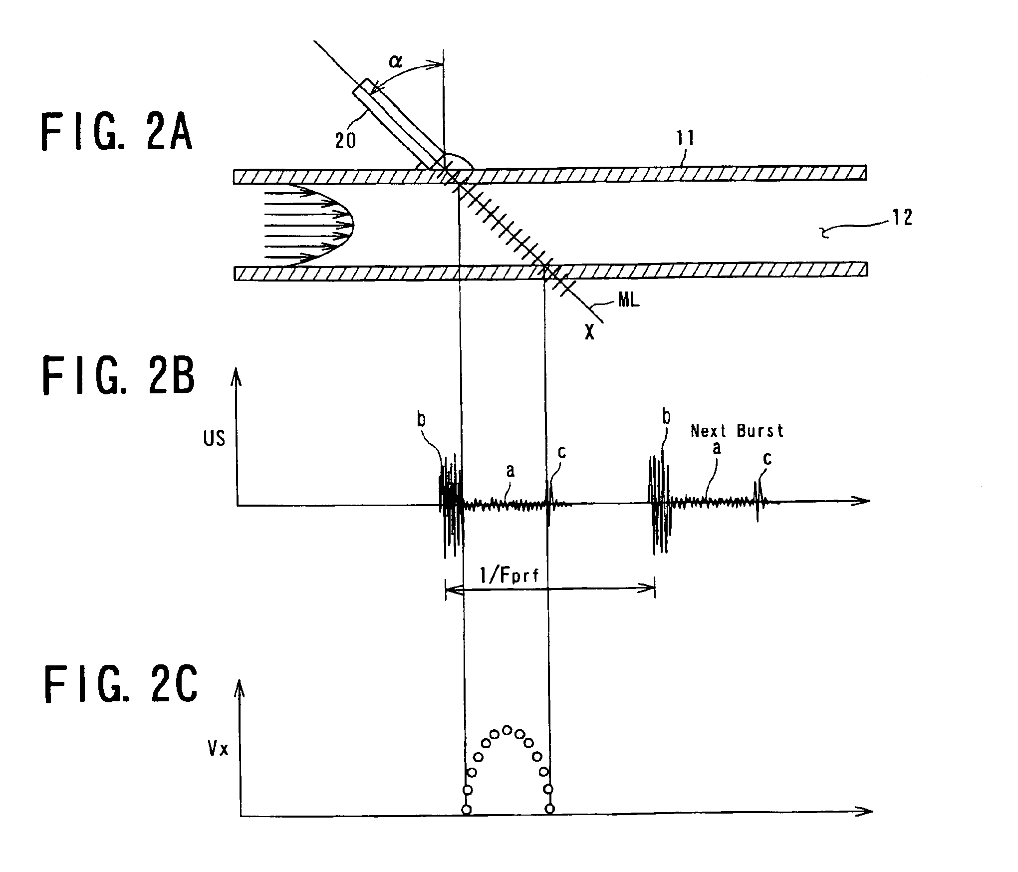 Doppler ultrasonic flowmeter