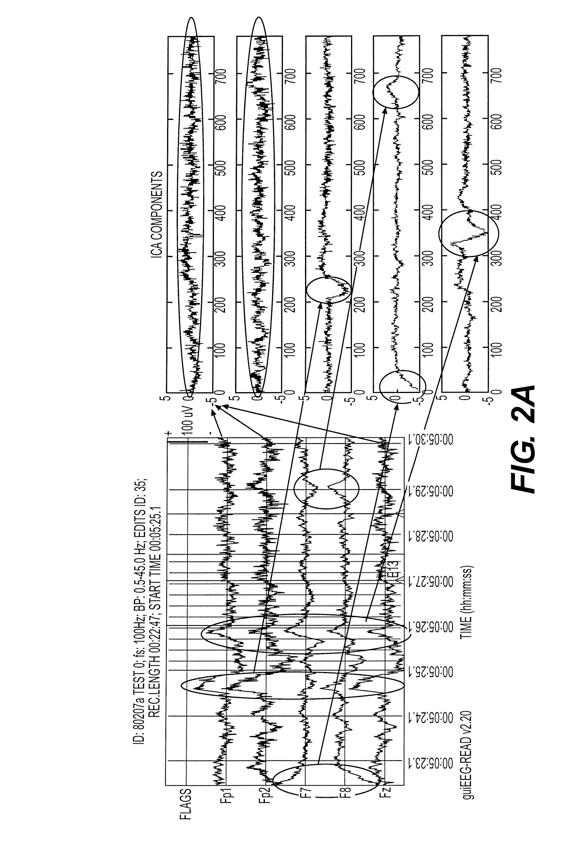 System and Method For Signal Denoising Using Independent Component Analysis and Fractal Dimension Estimation