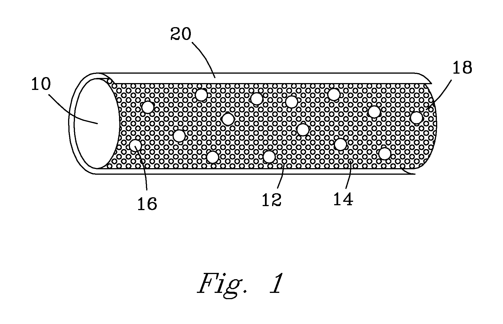 Brachytherapy Seed with Fast Dissolving Matrix for Optimal Delivery of Radionuclides to Cancer Tissue